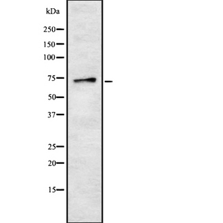 SCNN1G / ENaC Gamma Antibody - Western blot analysis of ENaC gamma using HeLa whole cells lysates