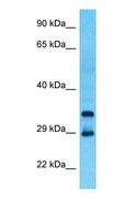 SCO1 Antibody - Western blot of SCO1 Antibody with human Large intestine Tumor lysate.  This image was taken for the unconjugated form of this product. Other forms have not been tested.