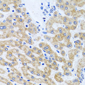 SCO1 Antibody - Immunohistochemistry of paraffin-embedded human liver using SCO1 antibody at dilution of 1:100 (x40 lens).