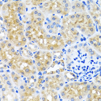 SCO1 Antibody - Immunohistochemistry of paraffin-embedded mouse kidney using SCO1 antibody at dilution of 1:100 (x40 lens).