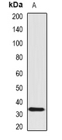 SCO1 Antibody - Western blot analysis of SCO1 expression in HeLa (A) whole cell lysates.