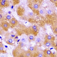 SCO1 Antibody - Immunohistochemical analysis of SCO1 staining in human liver formalin fixed paraffin embedded tissue section. The section was pre-treated using heat mediated antigen retrieval with sodium citrate buffer (pH 6.0). The section was then incubated with the antibody at room temperature and detected using an HRP conjugated compact polymer system. DAB was used as the chromogen. The section was then counterstained with hematoxylin and mounted with DPX.
