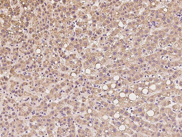 SCO1 Antibody - Immunochemical staining of human SCO1 in human liver with rabbit polyclonal antibody at 1:100 dilution, formalin-fixed paraffin embedded sections.