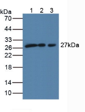 SCO2 Antibody - Western Blot; Sample: Lane1: Human MCF-7 Cells; Lane2: Human 293T Cells; Lane3: Human A431 Cells.