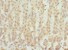 SCO2 Antibody - Immunohistochemistry of paraffin-embedded human adrenal gland tissue at dilution 1:100