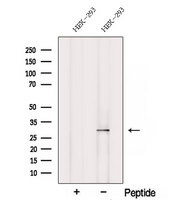 SCO2 Antibody - Western blot analysis of extracts of HEK293 cells using SCO2 antibody. The lane on the left was treated with blocking peptide.