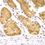 SCO2 Antibody - Immunohistochemistry of paraffin-embedded Human stomach using SCO2 Polyclonal Antibody at dilution of 1:100 (40x lens).