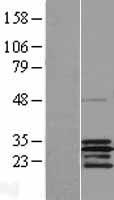 SCO2 Protein - Western validation with an anti-DDK antibody * L: Control HEK293 lysate R: Over-expression lysate