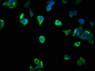 SCOC Antibody - Immunofluorescence staining of HepG2 cells with SCOC Antibody at 1:266, counter-stained with DAPI. The cells were fixed in 4% formaldehyde, permeabilized using 0.2% Triton X-100 and blocked in 10% normal Goat Serum. The cells were then incubated with the antibody overnight at 4°C. The secondary antibody was Alexa Fluor 488-congugated AffiniPure Goat Anti-Rabbit IgG(H+L).
