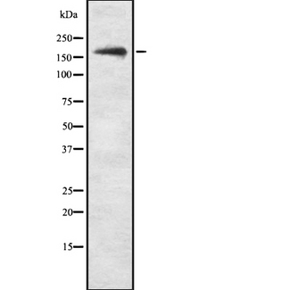 SCOP / PHLPP Antibody - Western blot analysis SCOP using COLO205 whole cells lysates