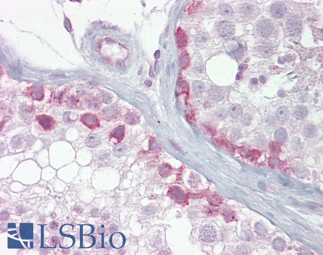 SCP1 / SYCP1 Antibody - Anti-SYCP1 antibody IHC of human testis. Immunohistochemistry of formalin-fixed, paraffin-embedded tissue after heat-induced antigen retrieval. Antibody concentration 5 ug/ml.  This image was taken for the unconjugated form of this product. Other forms have not been tested.