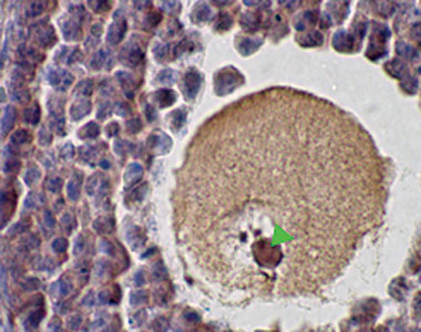 SCP1 / SYCP1 Antibody - Punctate staining of murine SCP1 in mouse ovary using Synaptonemal Complex Protein 1 Antibody (SCP1 Antibody).  This image was taken for the unconjugated form of this product. Other forms have not been tested.
