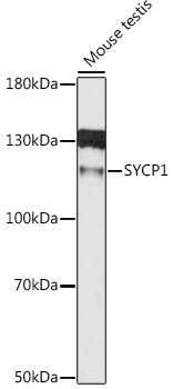 SCP1 / SYCP1 Antibody - Western blot analysis of extracts of mouse testis, using SYCP1 antibody at 1:1000 dilution. The secondary antibody used was an HRP Goat Anti-Rabbit IgG (H+L) at 1:10000 dilution. Lysates were loaded 25ug per lane and 3% nonfat dry milk in TBST was used for blocking. An ECL Kit was used for detection and the exposure time was 90s.