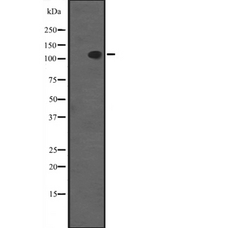 SCP1 / SYCP1 Antibody - Western blot analysis of SYCP1 expression in MCF-7 whole cells lysate. The lane on the left is treated with the antigen-specific peptide.