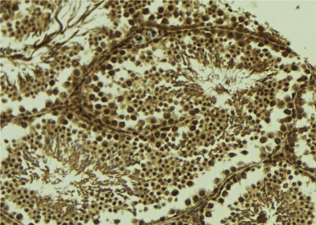 SCP1 / SYCP1 Antibody - 1:100 staining mouse testis tissue by IHC-P. The sample was formaldehyde fixed and a heat mediated antigen retrieval step in citrate buffer was performed. The sample was then blocked and incubated with the antibody for 1.5 hours at 22°C. An HRP conjugated goat anti-rabbit antibody was used as the secondary.