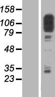 SCP1 / SYCP1 Protein - Western validation with an anti-DDK antibody * L: Control HEK293 lysate R: Over-expression lysate