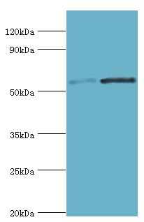 SCP2 / SCPX Antibody - Western blot. All lanes: Non-specific lipid-transfer protein antibody at 6 ug/ml. Lane 1: A2780 whole cell lysate. Lane 2: mouse liver tissue. Secondary antibody: Goat polyclonal to rabbit at 1:10000 dilution. Predicted band size: 59 kDa. Observed band size: 59 kDa Immunohistochemistry.