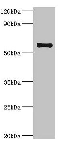 SCP2 / SCPX Antibody - Western blot All lanes: SCP2 antibody at 6µg/ml + A2780 whole cell lysate Secondary Goat polyclonal to rabbit IgG at 1/10000 dilution Predicted band size: 59, 16, 35, 51, 7, 55, 57 kDa Observed band size: 59 kDa