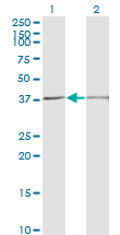 SCP2 / SCPX Antibody - Western Blot analysis of SCP2 expression in transfected 293T cell line by SCP2 monoclonal antibody (M01), clone 2E9-1B3.Lane 1: SCP2 transfected lysate (Predicted MW: 35 KDa).Lane 2: Non-transfected lysate.