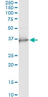 SCP2 / SCPX Antibody - Immunoprecipitation of SCP2 transfected lysate using anti-SCP2 monoclonal antibody and Protein A Magnetic Bead, and immunoblotted with SCP2 rabbit polyclonal antibody.