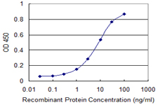SCP2 / SCPX Antibody - Detection limit for recombinant GST tagged SCP2 is 0.3 ng/ml as a capture antibody.