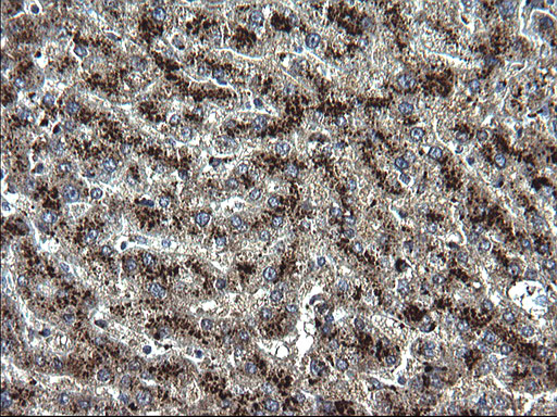 SCP2 / SCPX Antibody - IHC of paraffin-embedded Human liver tissue using anti-SCP2 mouse monoclonal antibody. (Heat-induced epitope retrieval by 1 mM EDTA in 10mM Tris, pH8.5, 120°C for 3min).