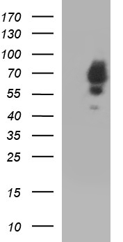 SCP2 / SCPX Antibody - HEK293T cells were transfected with the pCMV6-ENTRY control (Left lane) or pCMV6-ENTRY SCP2 (Right lane) cDNA for 48 hrs and lysed. Equivalent amounts of cell lysates (5 ug per lane) were separated by SDS-PAGE and immunoblotted with anti-SCP2.