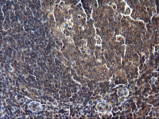 SCP2 / SCPX Antibody - IHC of paraffin-embedded Human lymph node tissue using anti-SCP2 mouse monoclonal antibody. (Heat-induced epitope retrieval by 1 mM EDTA in 10mM Tris, pH8.5, 120°C for 3min).