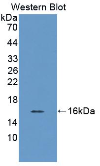SCP2 / SCPX Antibody - Western Blot; Sample: Recombinant protein.
