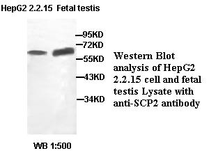 SCP2 / SCPX Antibody