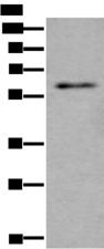 SCP2 / SCPX Antibody - Western blot analysis of Mouse testis tissue lysate  using SCP2 Polyclonal Antibody at dilution of 1:350