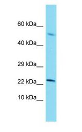 SCP2 / SCPX Antibody - SCP2 / SCPX antibody Western Blot of Thymus Tumor. Antibody dilution: 1 ug/ml.  This image was taken for the unconjugated form of this product. Other forms have not been tested.