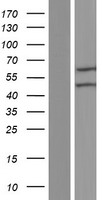 SCP2 / SCPX Protein - Western validation with an anti-DDK antibody * L: Control HEK293 lysate R: Over-expression lysate