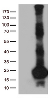 SCP2D1 / C20orf79 Antibody - HEK293T cells were transfected with the pCMV6-ENTRY control. (Left lane) or pCMV6-ENTRY C20orf79. (Right lane) cDNA for 48 hrs and lysed. Equivalent amounts of cell lysates. (5 ug per lane) were separated by SDS-PAGE and immunoblotted with anti-C20orf79. (1:2000)