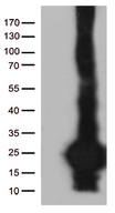 SCP2D1 / C20orf79 Antibody - HEK293T cells were transfected with the pCMV6-ENTRY control. (Left lane) or pCMV6-ENTRY C20orf79. (Right lane) cDNA for 48 hrs and lysed. Equivalent amounts of cell lysates. (5 ug per lane) were separated by SDS-PAGE and immunoblotted with anti-C20orf79. (1:2000)