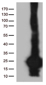 SCP2D1 / C20orf79 Antibody - HEK293T cells were transfected with the pCMV6-ENTRY control. (Left lane) or pCMV6-ENTRY C20orf79. (Right lane) cDNA for 48 hrs and lysed