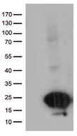 SCP2D1 / C20orf79 Antibody - HEK293T cells were transfected with the pCMV6-ENTRY control. (Left lane) or pCMV6-ENTRY C20orf79. (Right lane) cDNA for 48 hrs and lysed. Equivalent amounts of cell lysates. (5 ug per lane) were separated by SDS-PAGE and immunoblotted with anti-C20orf79. (1:500)