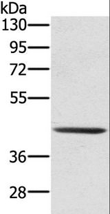 SCPEP1 / RISC Antibody - Western blot analysis of 231 cell, using SCPEP1 Polyclonal Antibody at dilution of 1:300.