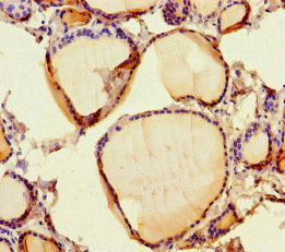 SCPEP1 / RISC Antibody - Immunohistochemistry of paraffin-embedded human thyroid tissue at dilution of 1:100