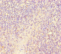 SCPEP1 / RISC Antibody - Immunohistochemistry of paraffin-embedded human tonsil tissue at dilution of 1:100