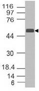 SCPEP1 / RISC Antibody - Fig-1: Western blot analysis of RISC. Anti-RISC antibody was used at 1 µg/ml on h Liver lysate.