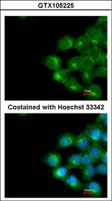 Scramblase / PLSCR1 Antibody - Immunofluorescence of methanol-fixed A431 using Scramblase1 antibody at 1:200 dilution.