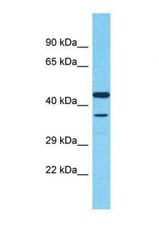 Scramblase / PLSCR1 Antibody - Western blot of Human MCF7 cell lysate. PLSCR1 antibody dilution 1.0 ug/ml.  This image was taken for the unconjugated form of this product. Other forms have not been tested.