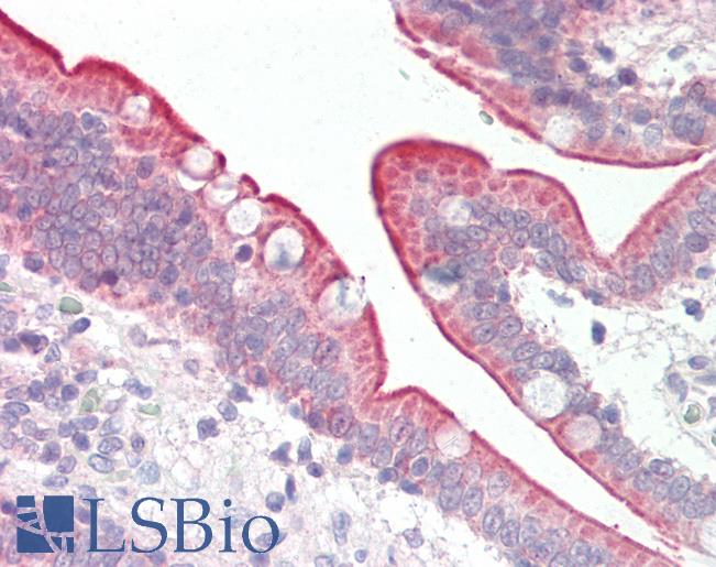 Scramblase / PLSCR1 Antibody - Human Small Intestine: Formalin-Fixed, Paraffin-Embedded (FFPE).  This image was taken for the unconjugated form of this product. Other forms have not been tested.