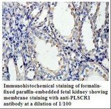 Scramblase / PLSCR1 Antibody
