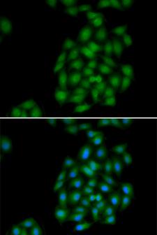 Scramblase / PLSCR1 Antibody - Immunofluorescence analysis of HeLa cells.