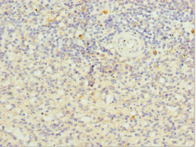 Scramblase / PLSCR1 Antibody - Immunohistochemistry of paraffin-embedded human spleen tissue at dilution 1:100