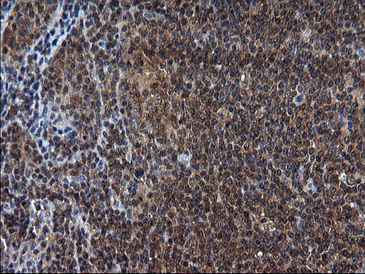 SCRN1 / Secernin 1 Antibody - IHC of paraffin-embedded Human lymphoma tissue using anti-SCRN1 mouse monoclonal antibody. (Heat-induced epitope retrieval by 1 mM EDTA in 10mM Tris, pH8.5, 120°C for 3min).