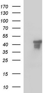 SCRN1 / Secernin 1 Antibody - HEK293T cells were transfected with the pCMV6-ENTRY control (Left lane) or pCMV6-ENTRY SCRN1 (Right lane) cDNA for 48 hrs and lysed. Equivalent amounts of cell lysates (5 ug per lane) were separated by SDS-PAGE and immunoblotted with anti-SCRN1.