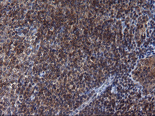 SCRN1 / Secernin 1 Antibody - IHC of paraffin-embedded Human lymphoma tissue using anti-SCRN1 mouse monoclonal antibody. (Heat-induced epitope retrieval by 1 mM EDTA in 10mM Tris, pH8.5, 120°C for 3min).